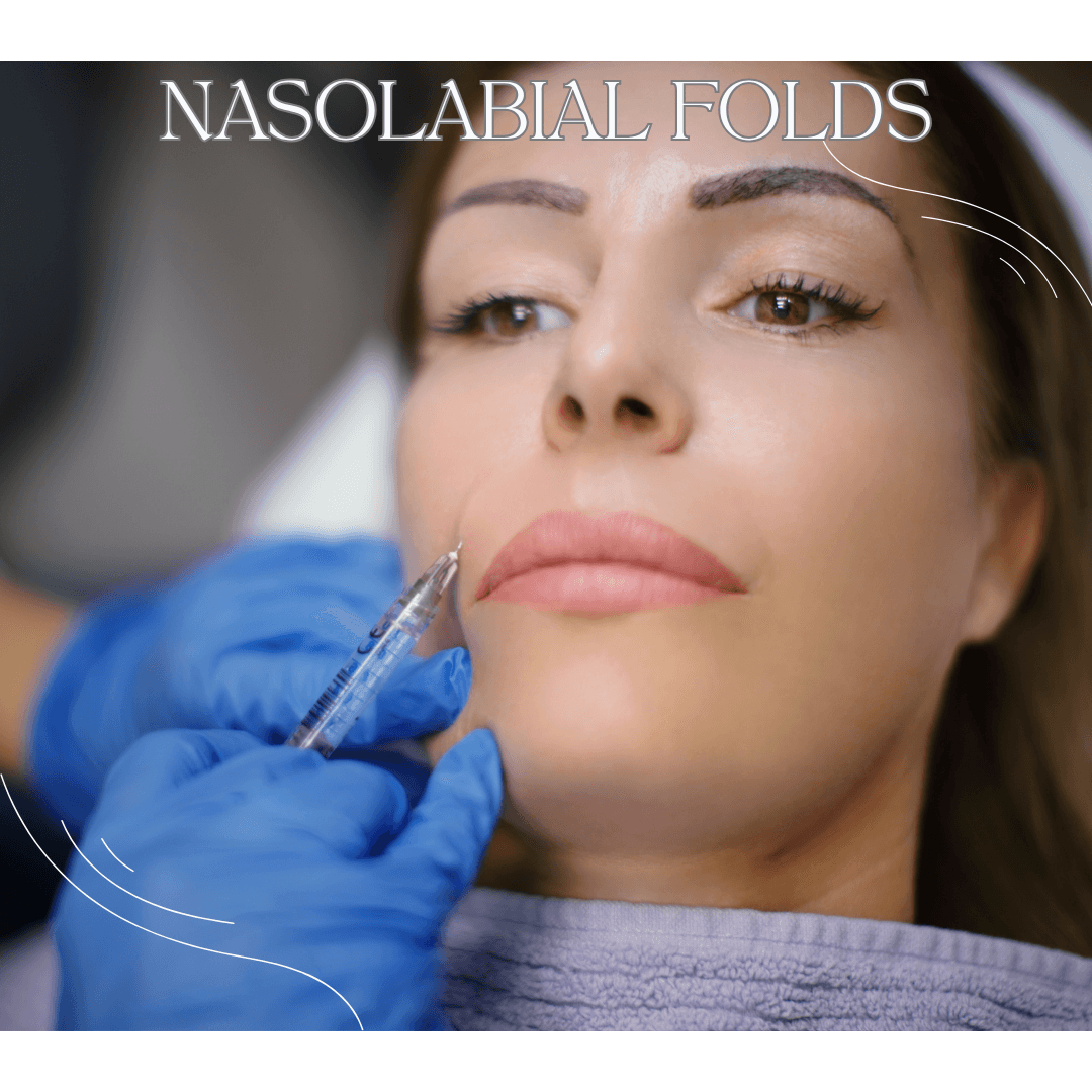 NASOLABIAL FOLDS