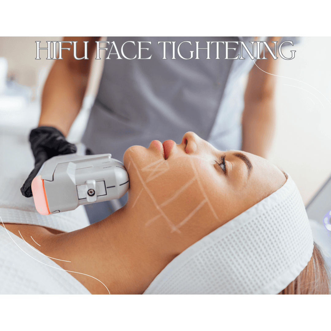 HIFU FACE TIGHTENING