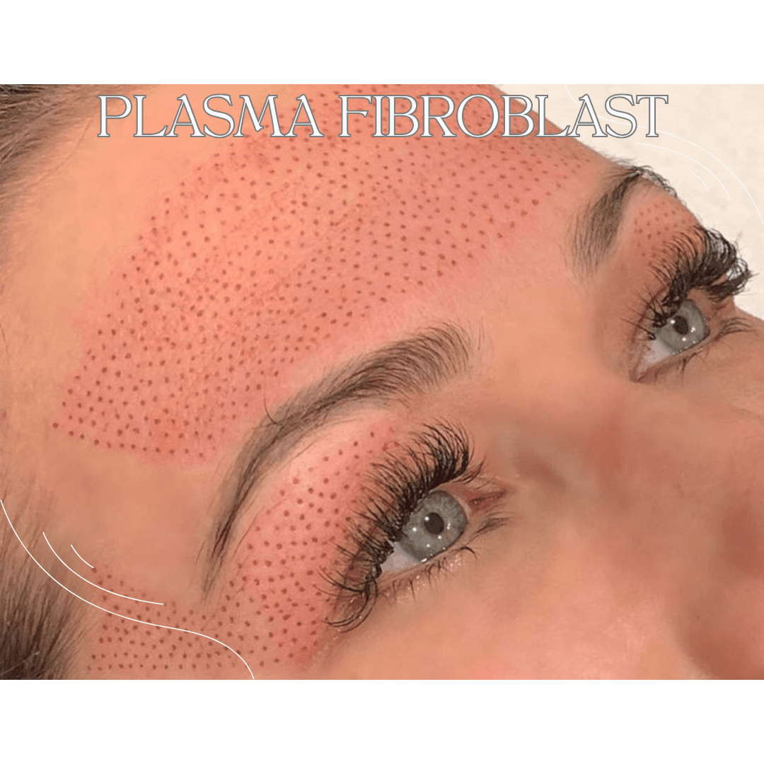 PLASMA FIBROBLAST