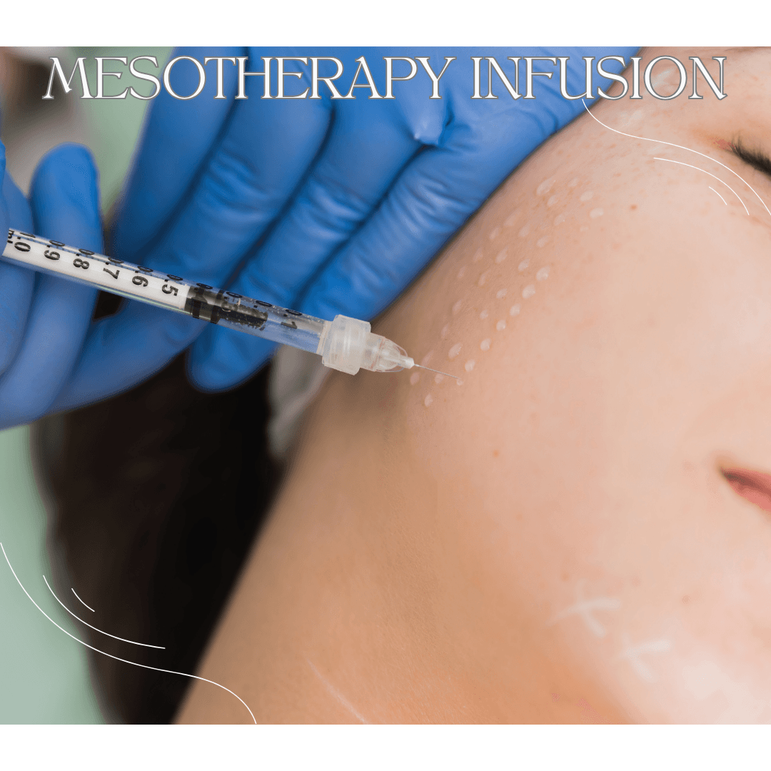 MESOTHERAPY INFUSION