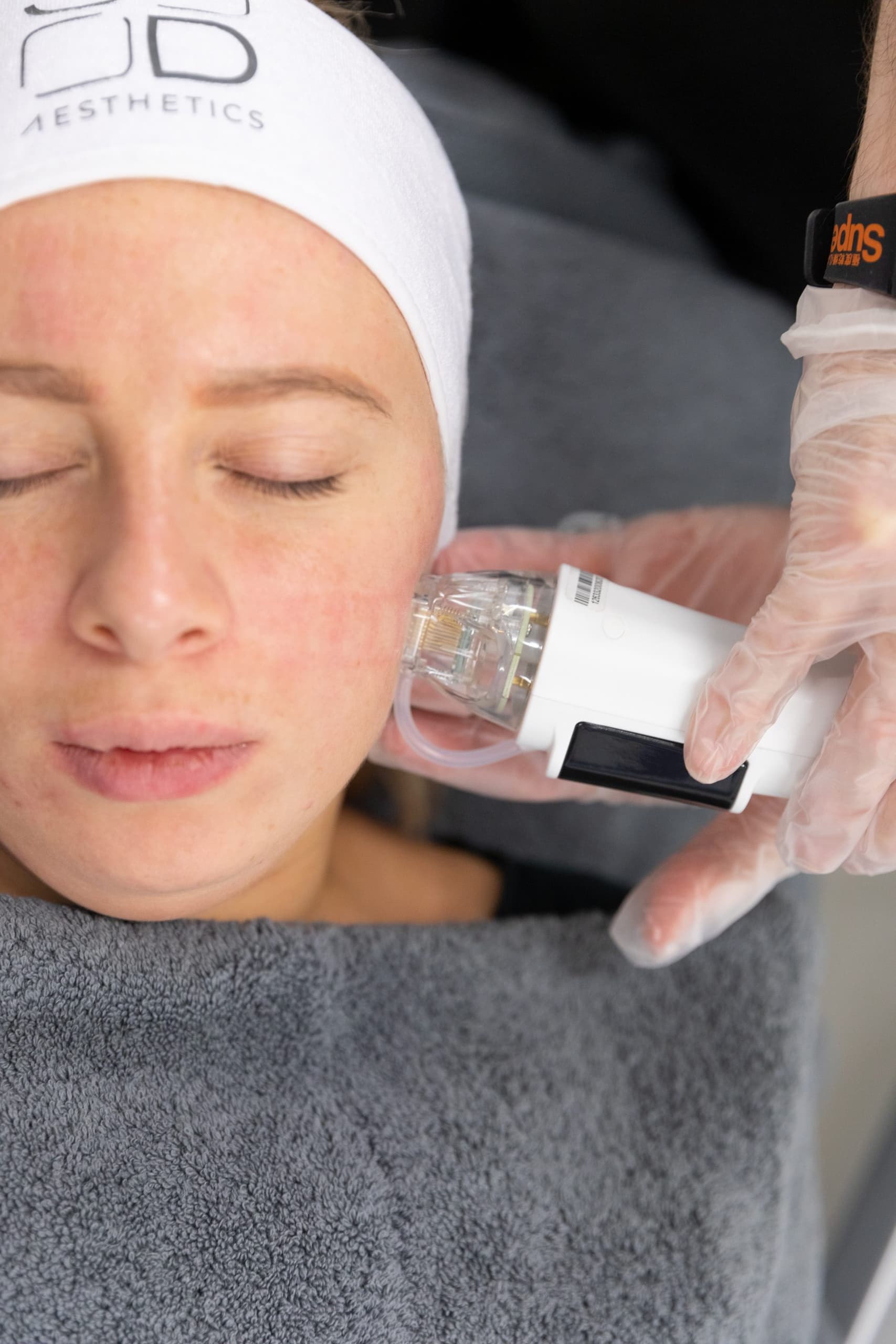  Experience the next level of non-surgical skin rejuvenation with the revolutionary 3D Dermaforce!