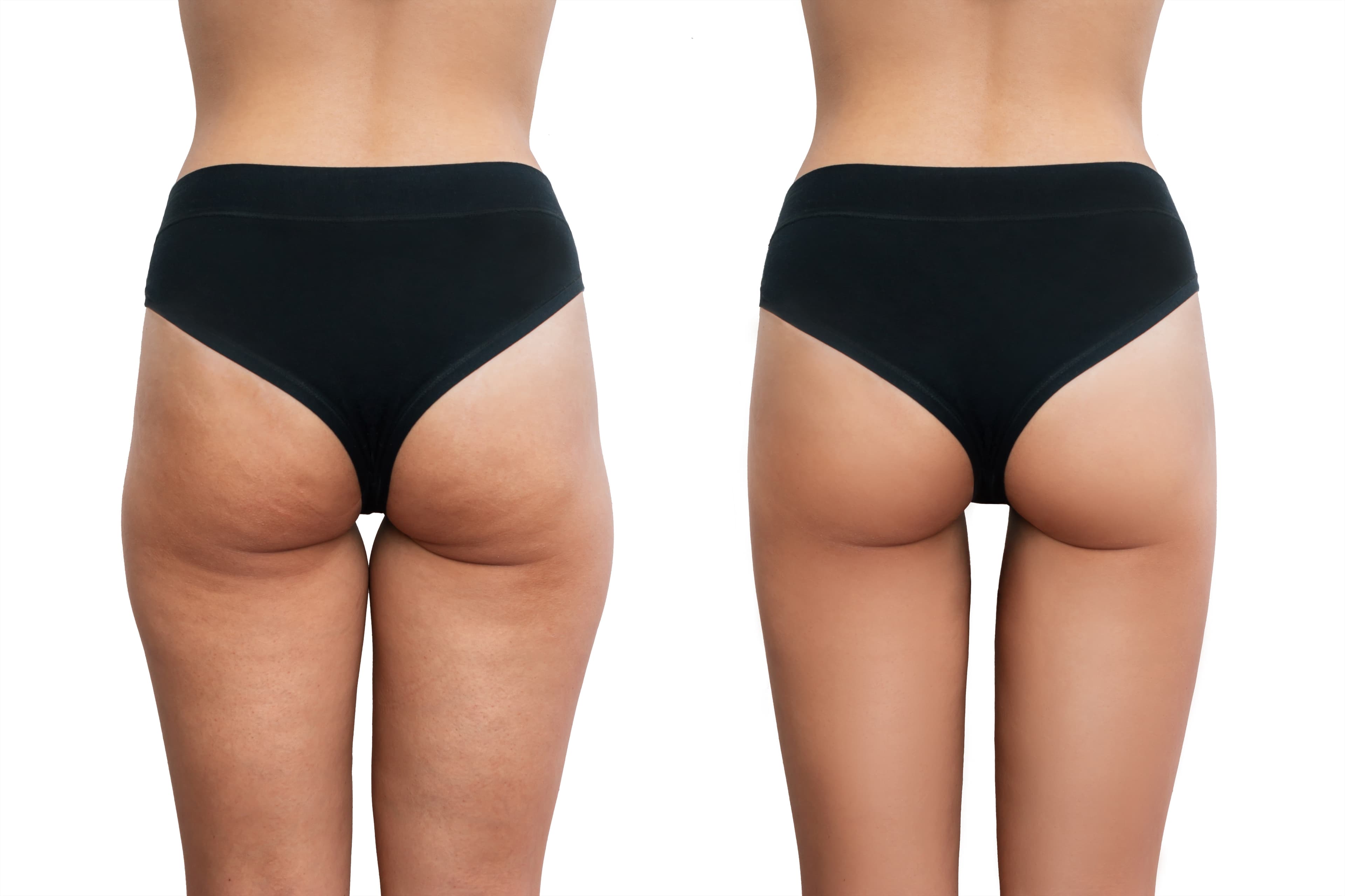 3d Thigh Gap