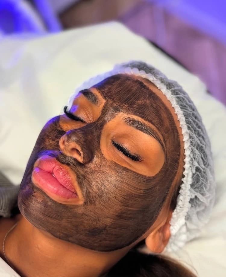 Carbon Laser Facial Achieve a flawless, radiant complexion with the Carbon Laser Facial, also known as the Hollywood Peel. Book Today!
