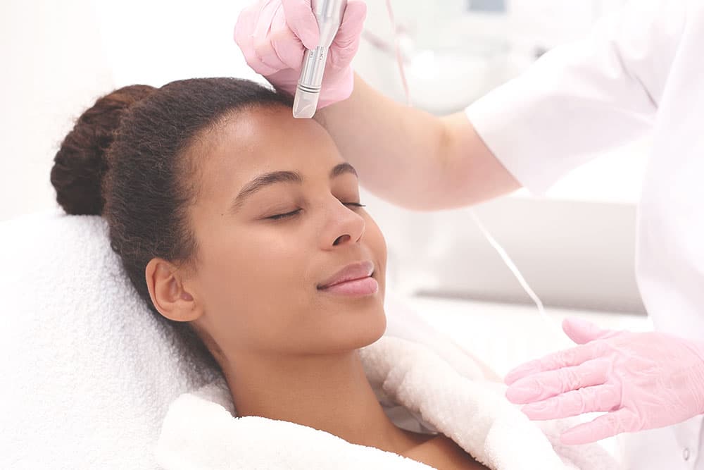 Best Non-Surgical Treatments for Acne Scars