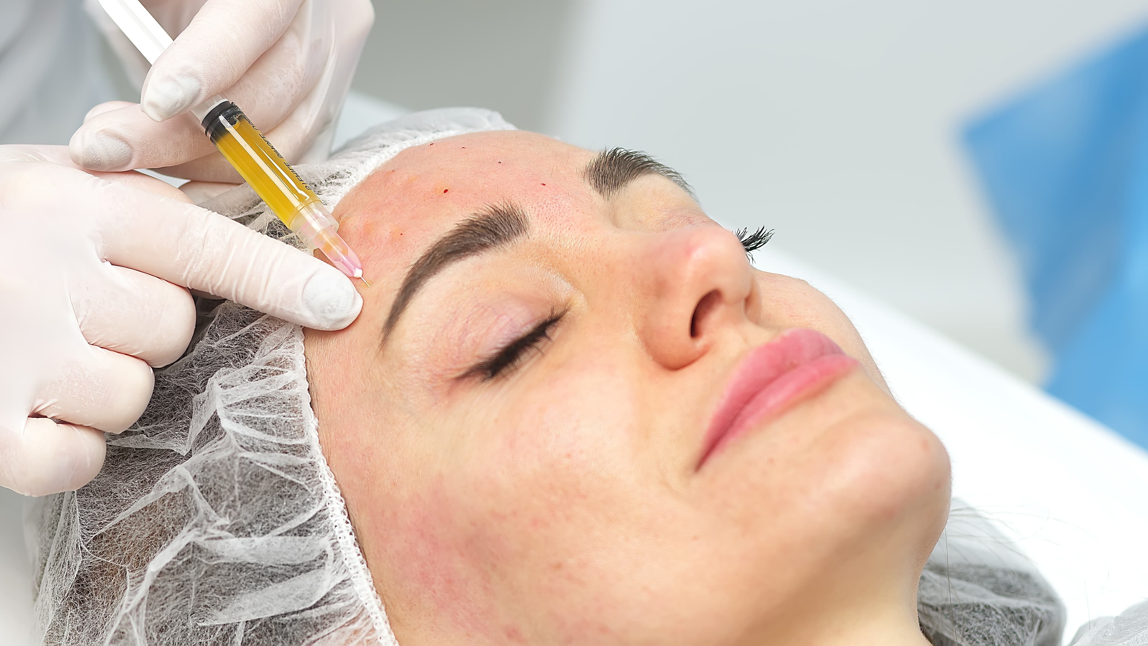 PRP Targeted Rejuvenation