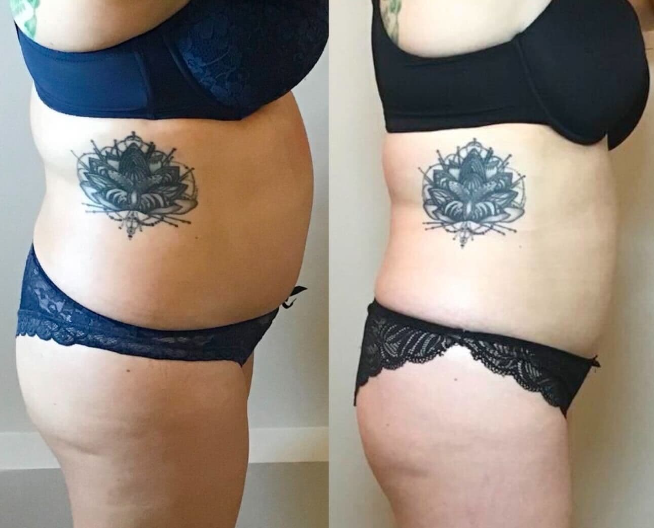 5 Point Contour & Lift