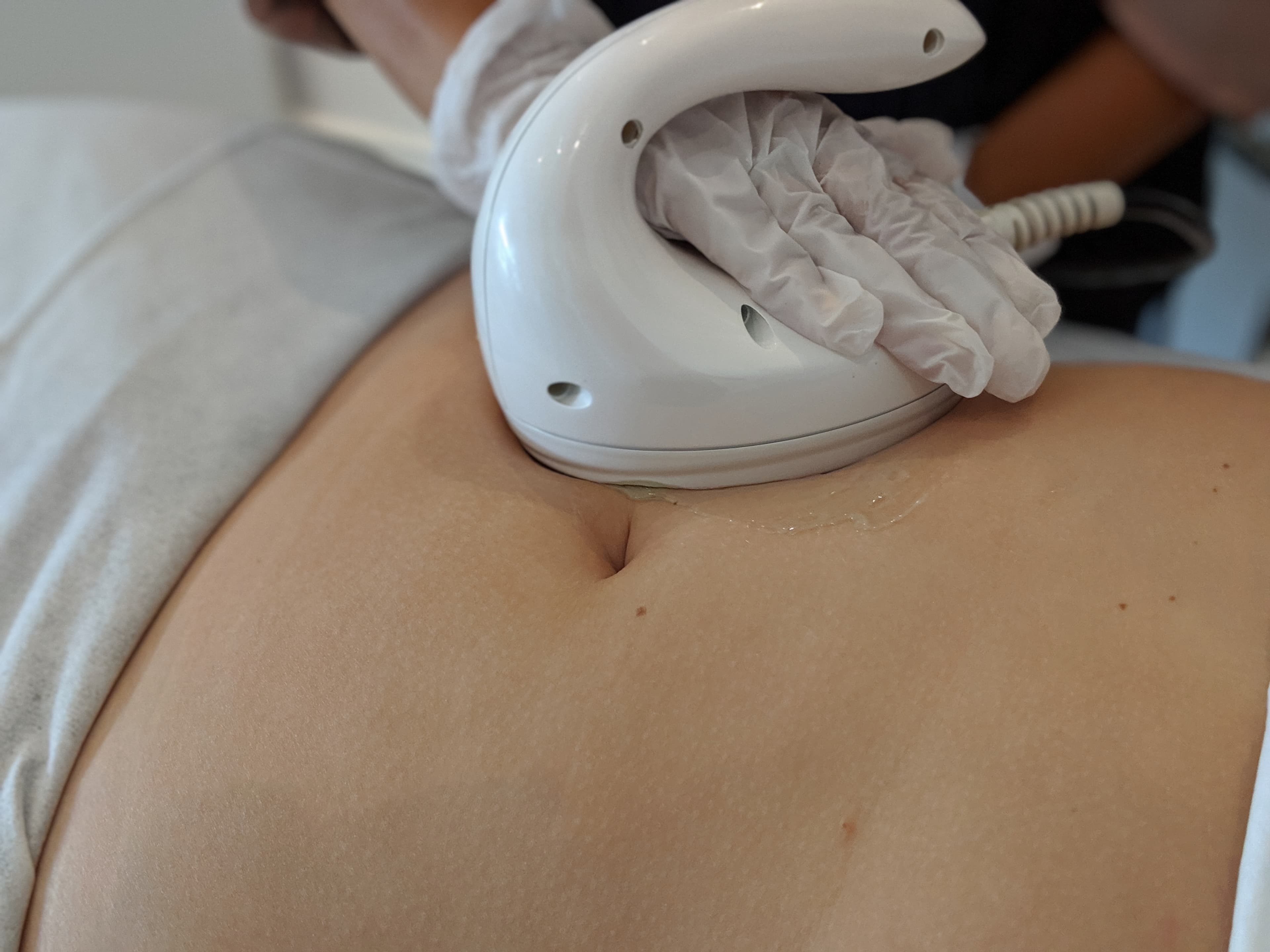 Lymphatic Drainage & Shockwave Therapy