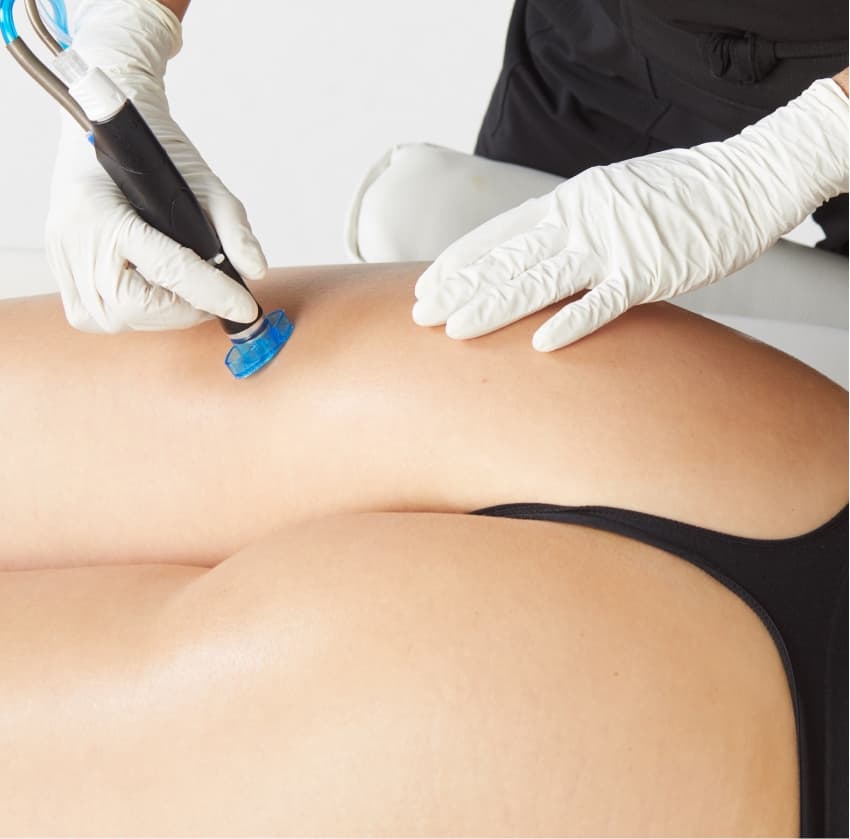Hydrafacial - Hydra Booty Facial