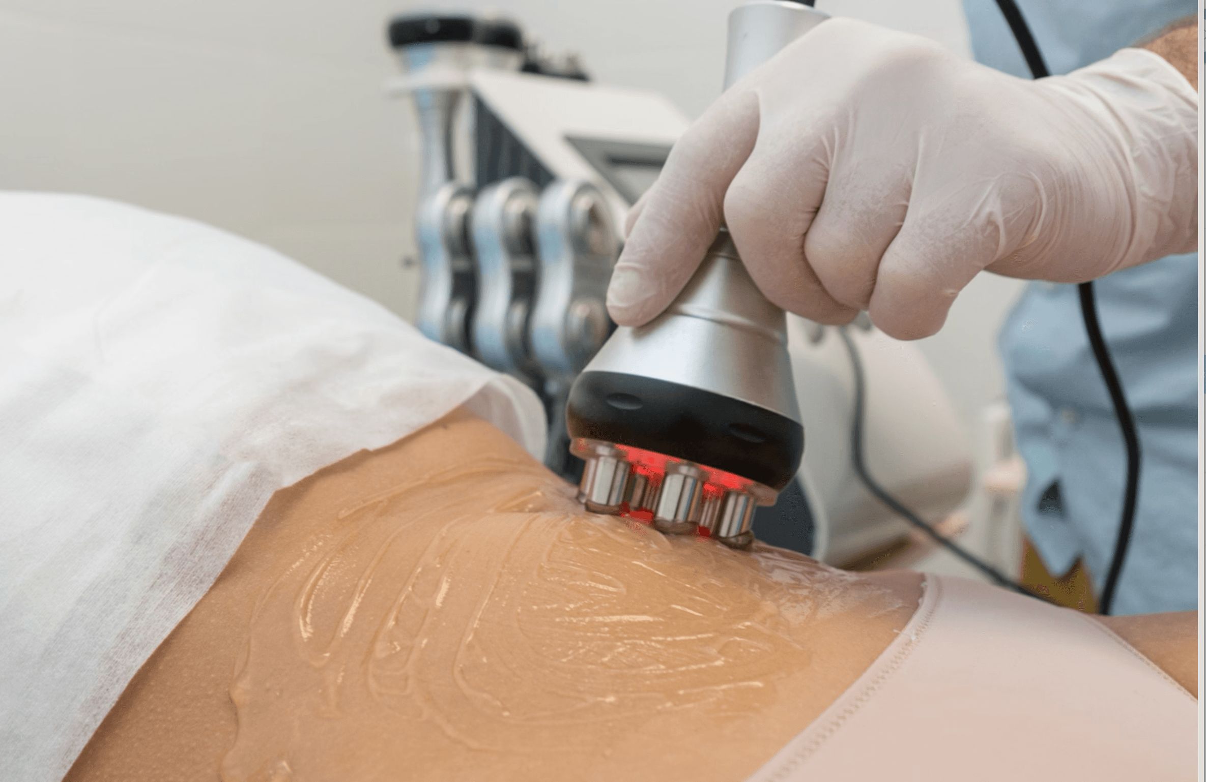 Body Radiofrequency