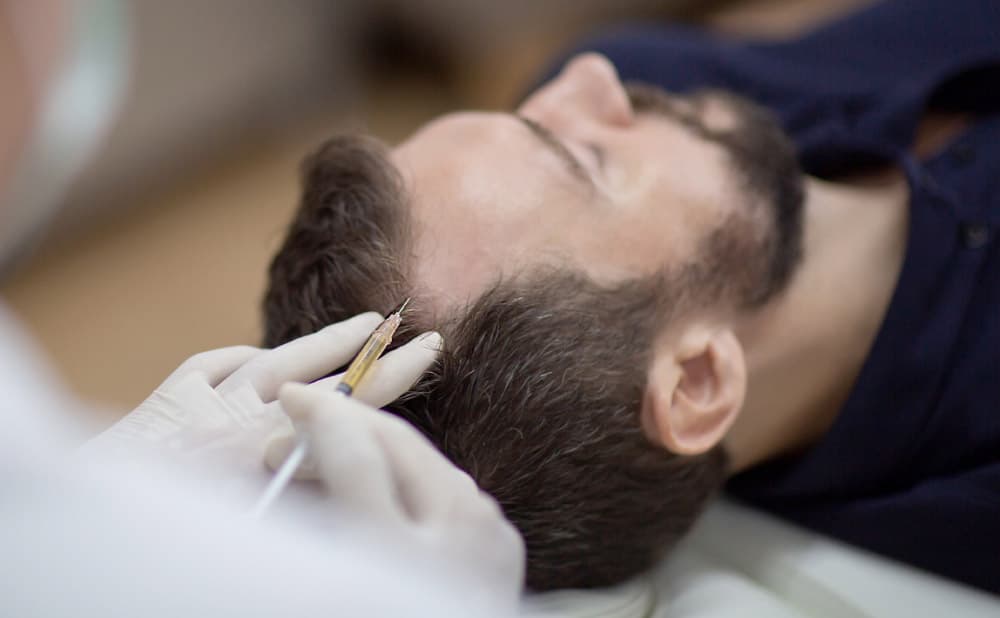 Hair Growth Mesotherapy